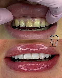 دندانپزشکی نیکا(طرف قراردادبیمه نیستیم)