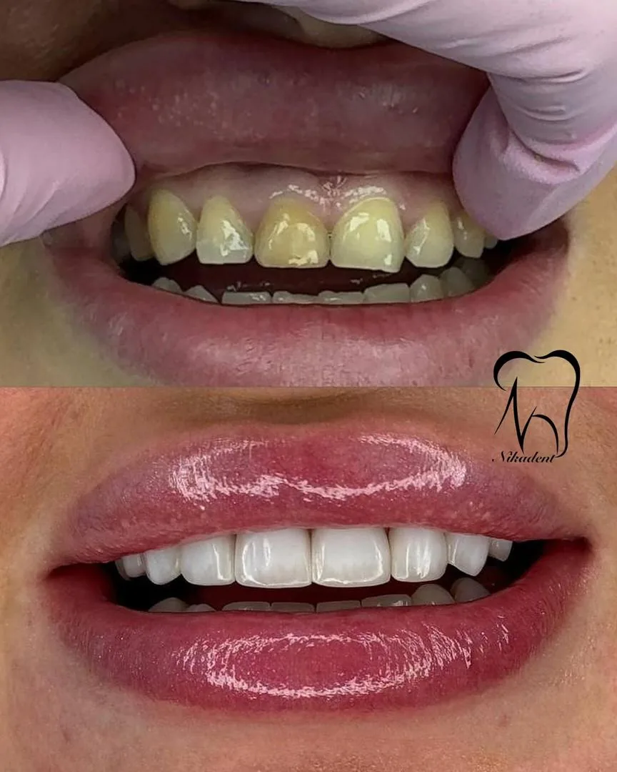 دندانپزشکی نیکا(طرف قراردادبیمه نیستیم)