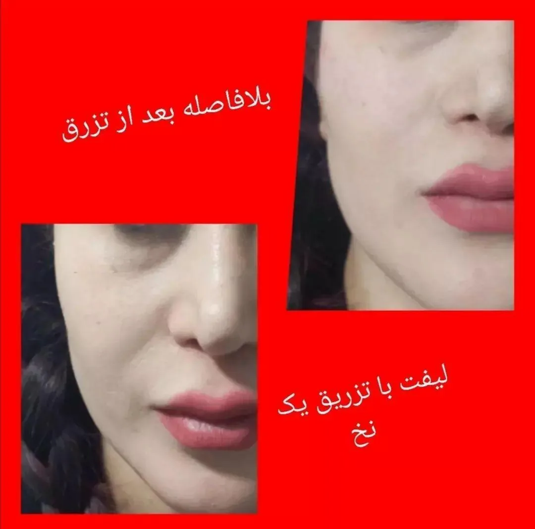 مجتمع پزشکی موج (پوست و زیبایی) - تصویر 3