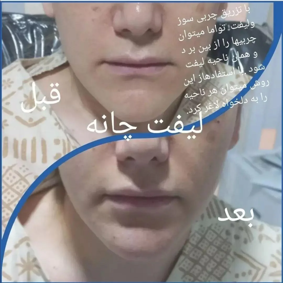 مجتمع پزشکی موج (پوست و زیبایی) - تصویر 4