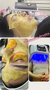 فیشیال و پاکسازی عاطفی