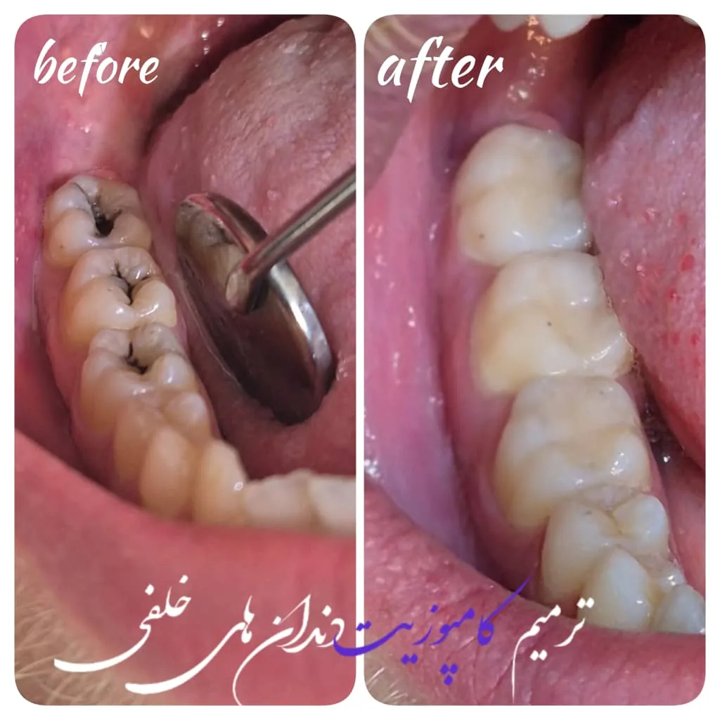مرکز تخصصی دندانپزشکی پاسارگاد - تصویر 3
