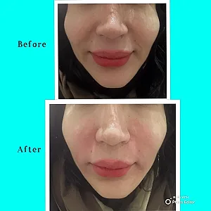 مرکز لیزر و فیشال ستاره