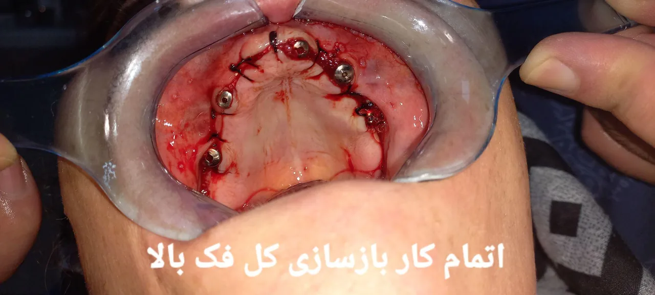 مرکز تخصصی ایمپلنت و دندانپزشکی درنیک - تصویر 2