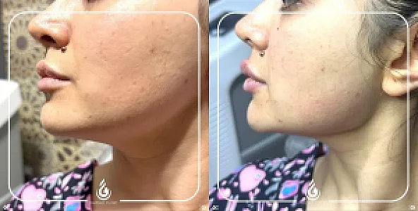کلینیک پوست مو زیبایی و لیرز فرداد