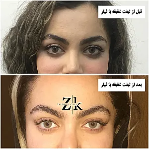 کلینیک زیبایی زهرا کیا