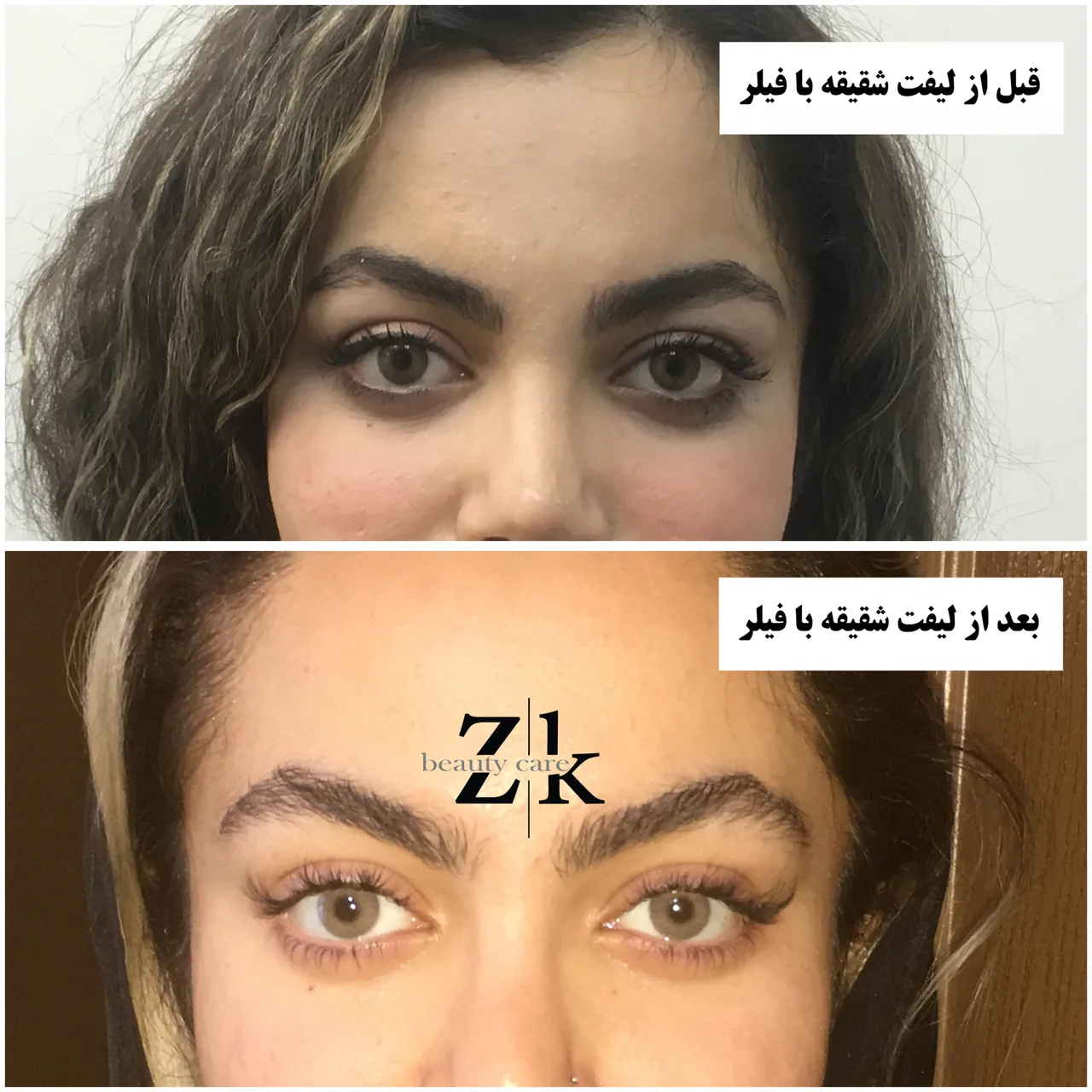 کلینیک زیبایی زهرا کیا