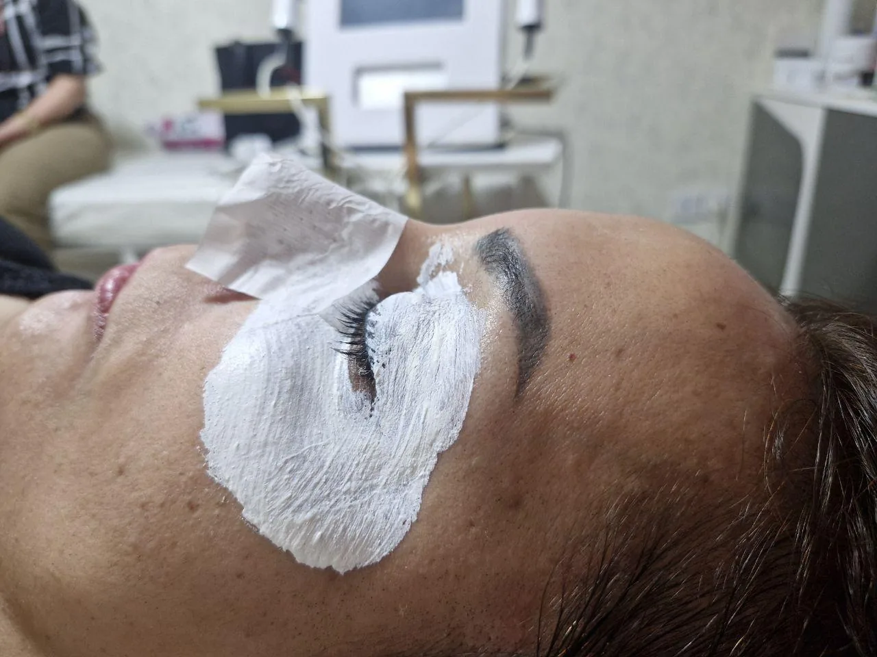فیشیال تخصصی و کلینیکی - تصویر 2