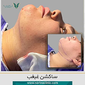 کلینیک پوست ، مو و لیزر نارینا