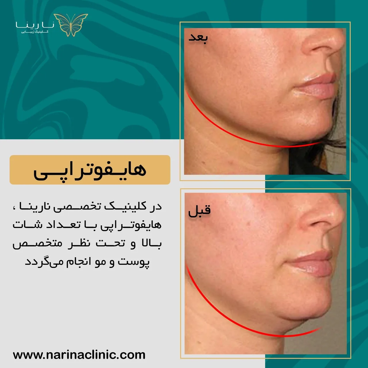 کلینیک پوست ، مو و لیزر نارینا - تصویر 2