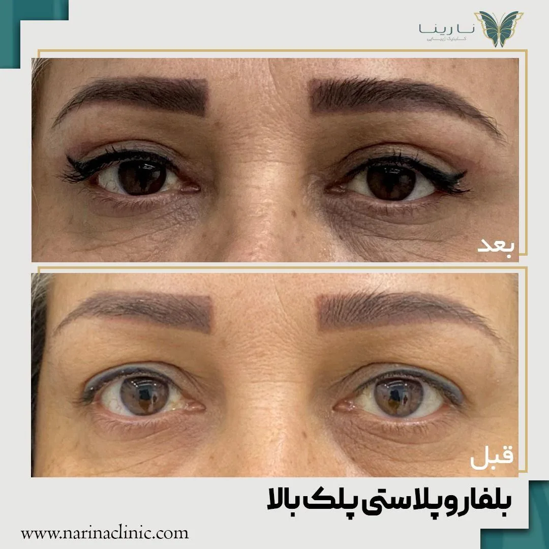 کلینیک پوست ، مو و لیزر نارینا - تصویر 3