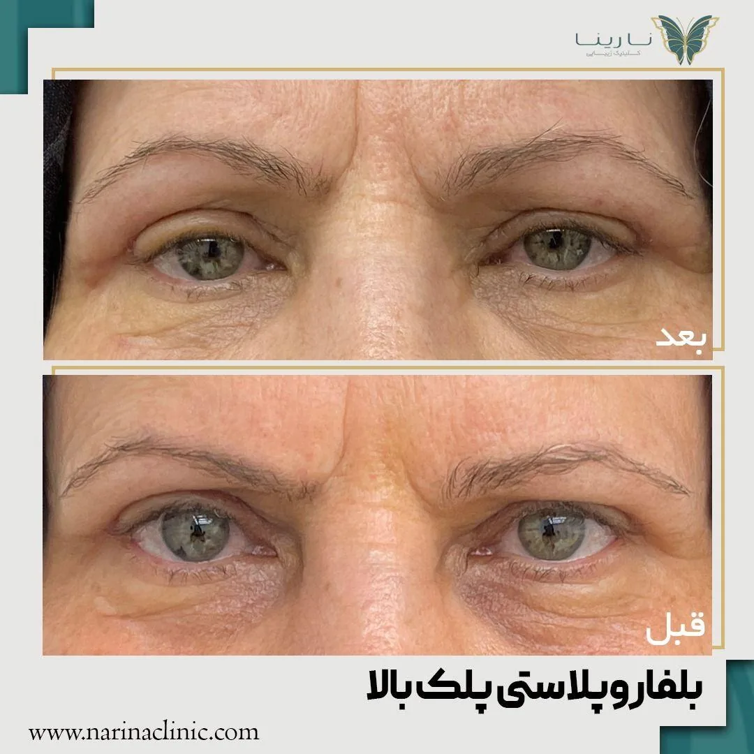 کلینیک پوست ، مو و لیزر نارینا - تصویر 4