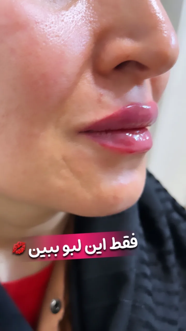 مرکز لیزر لاغری کلینیک زیبایی مهشیدذاکری - تصویر 3
