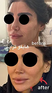 کلینیک زیبایی زرماه