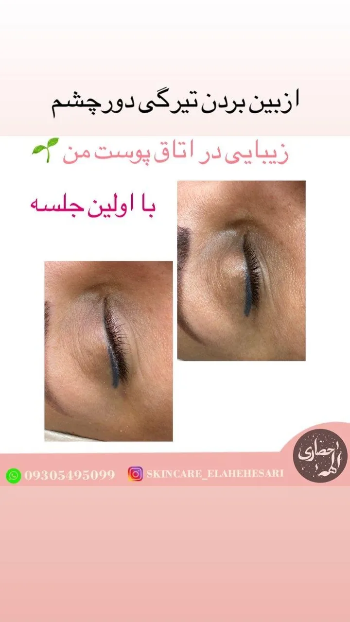 بیوتی تراپیست الهه حصاری - تصویر 3