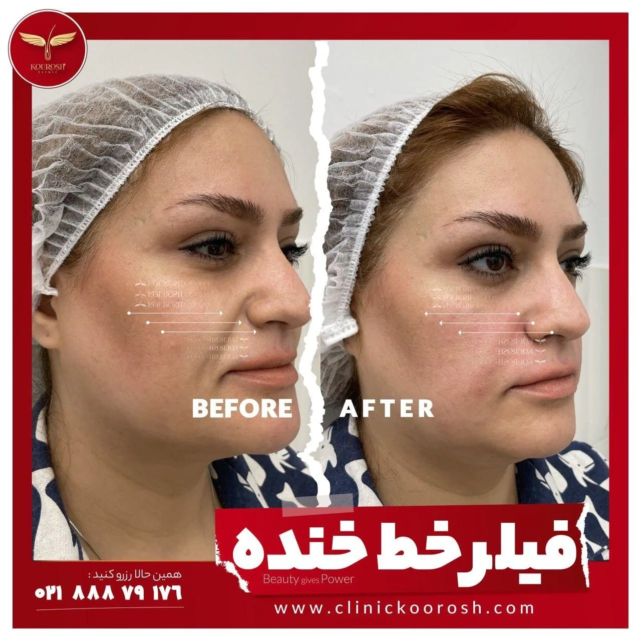 کلینیک تخصصی زیبایی و لیزر کوروش - تصویر 2