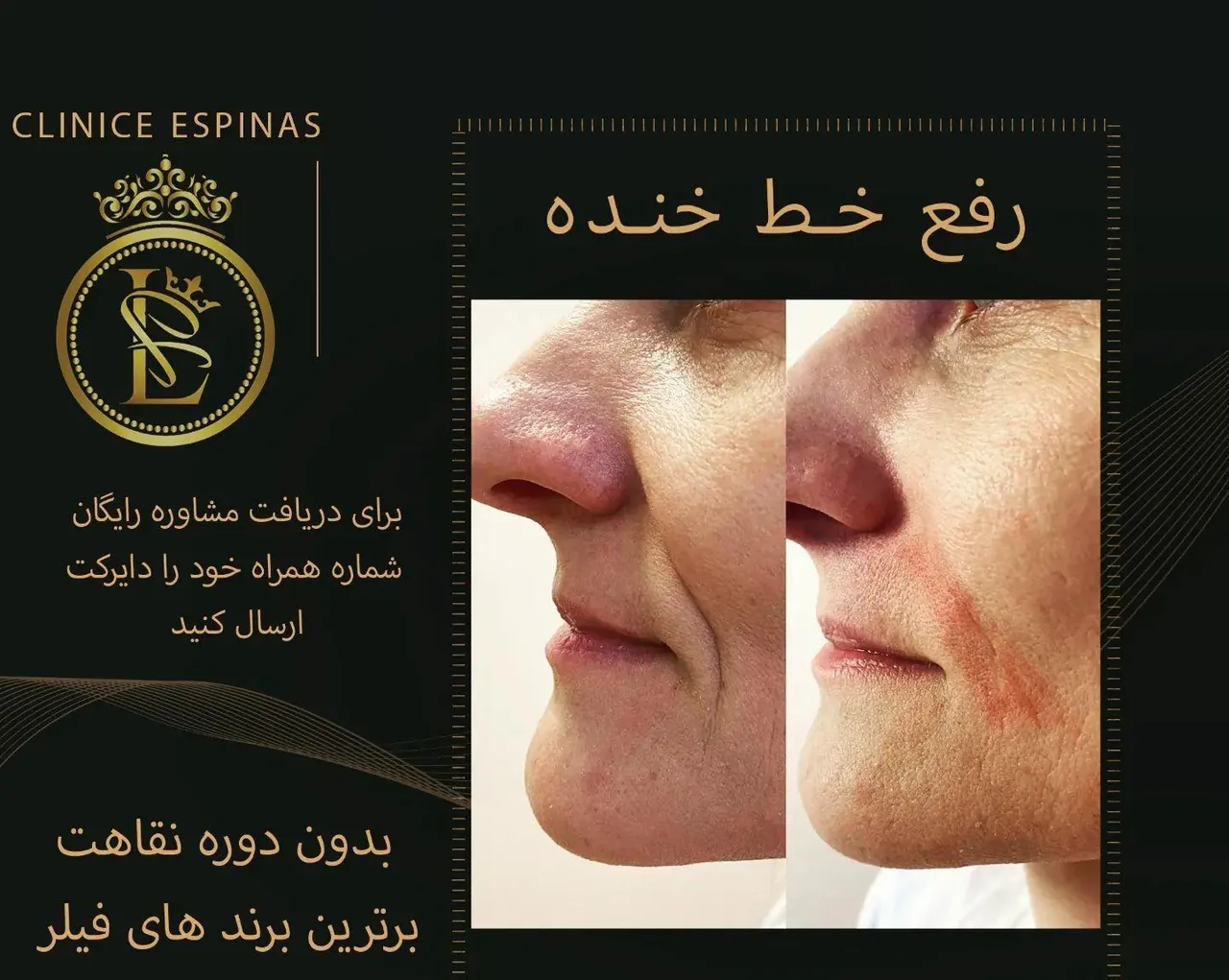 کلینیک زیبایی و لیزر اسپیناس - تصویر 3