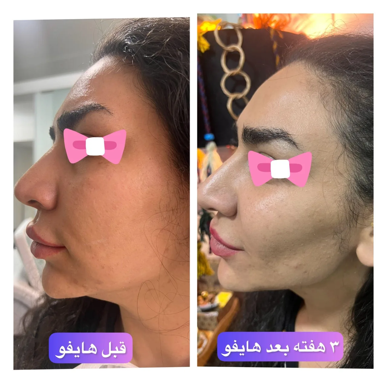 مرکز پوست مو زیبایی گانلی - تصویر 2