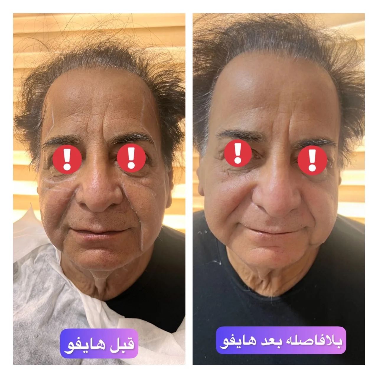 مرکز پوست مو زیبایی گانلی - تصویر 3