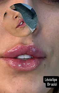 کلینیک زیبایی  اسا