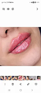 مرکز لیزر و زیبایی زروانی