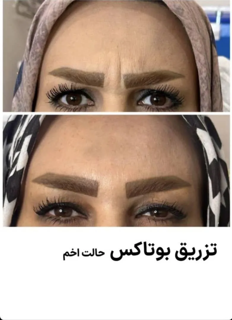 مرکز لیزر و زیبایی زروانی - تصویر 2