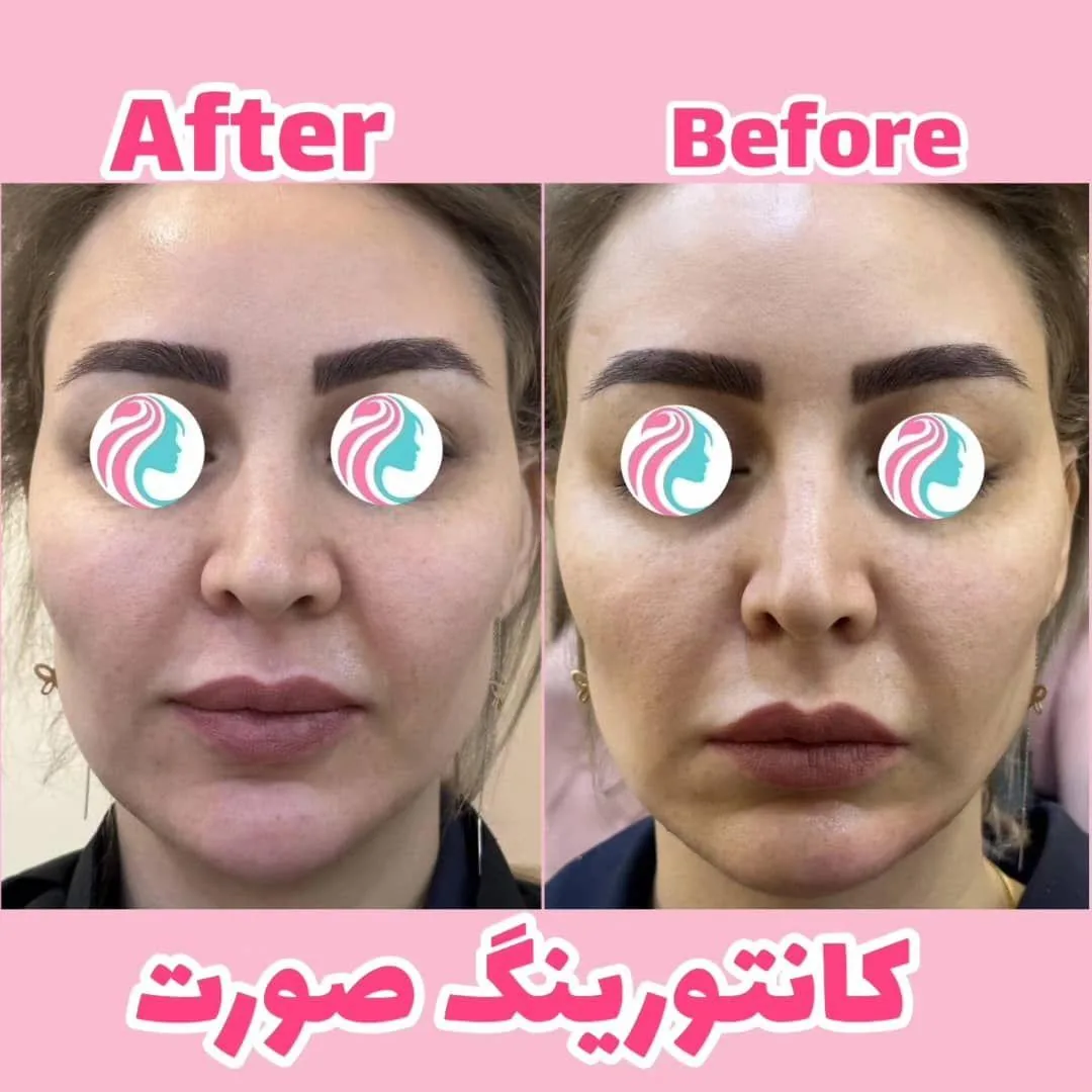 مرکز لیزر و زیبایی زروانی - تصویر 4