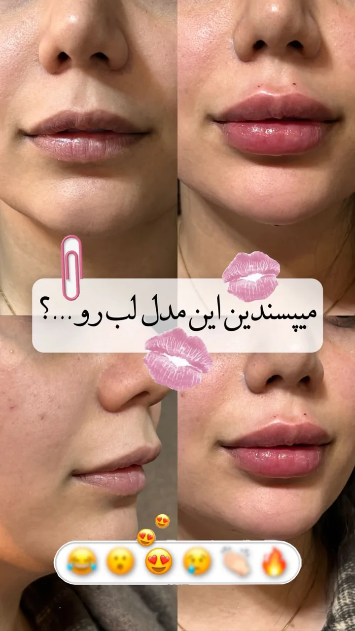 کلینیک زیبایی و مرکز لیزر پارلار - تصویر 3