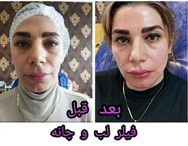 کلینیک زیبایی درمانی پرنسس