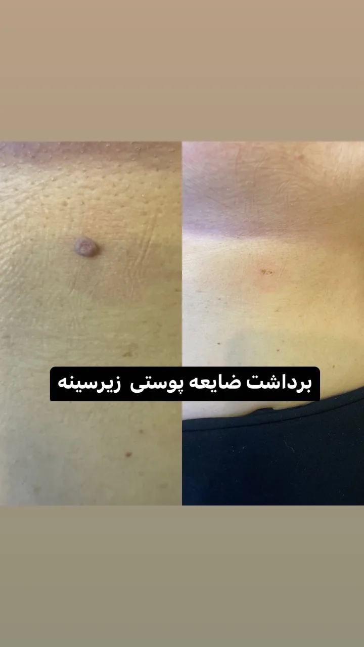 کلینیک زیبایی درمانی به تن رو - تصویر 2