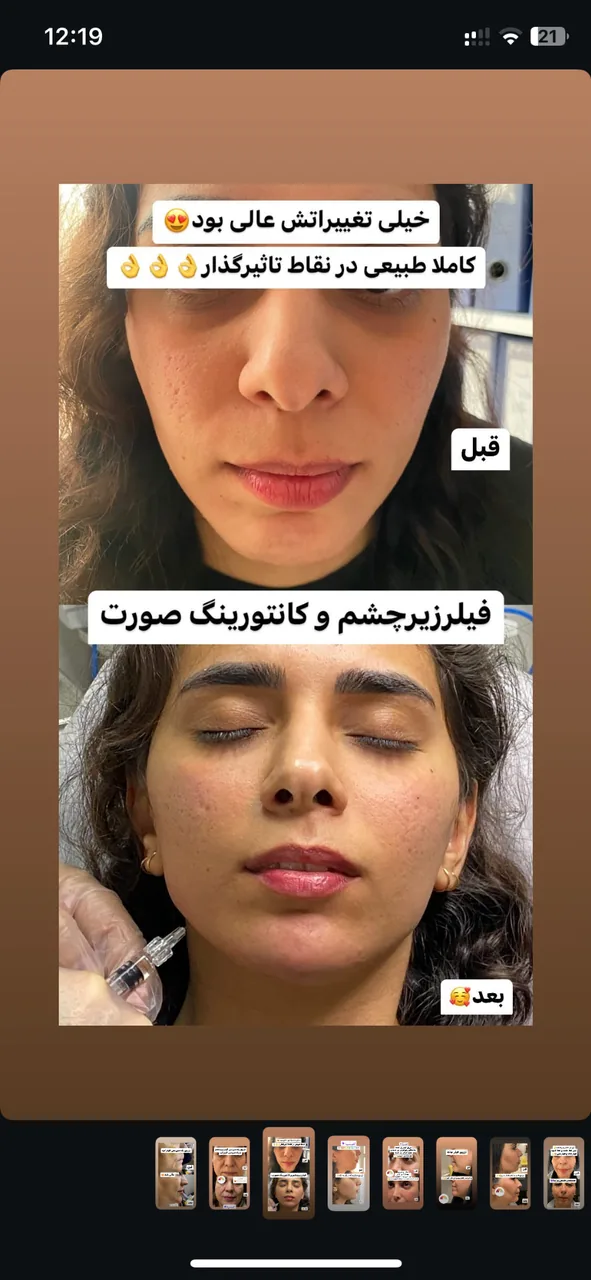 مرکز لیزر،پوست،مو و زیبایی اقدسیه(شادن) - تصویر 3