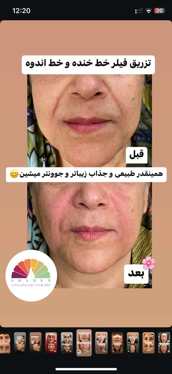 مرکز لیزر،پوست،مو و زیبایی اقدسیه(شادن) - تصویر 4