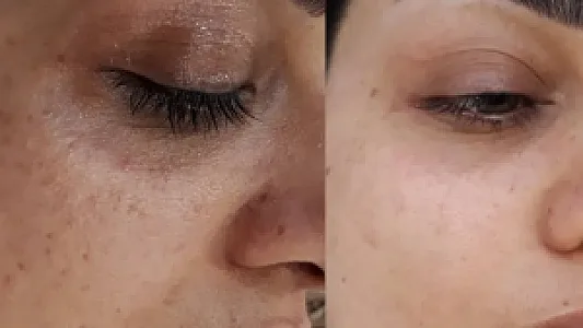 مرکز فیشیال و پاکسازی پوست(استاد جلالی)