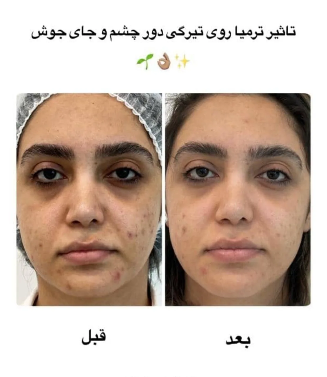 کلینیک زیبایی و مرکز لیزر آتی نو - تصویر 4