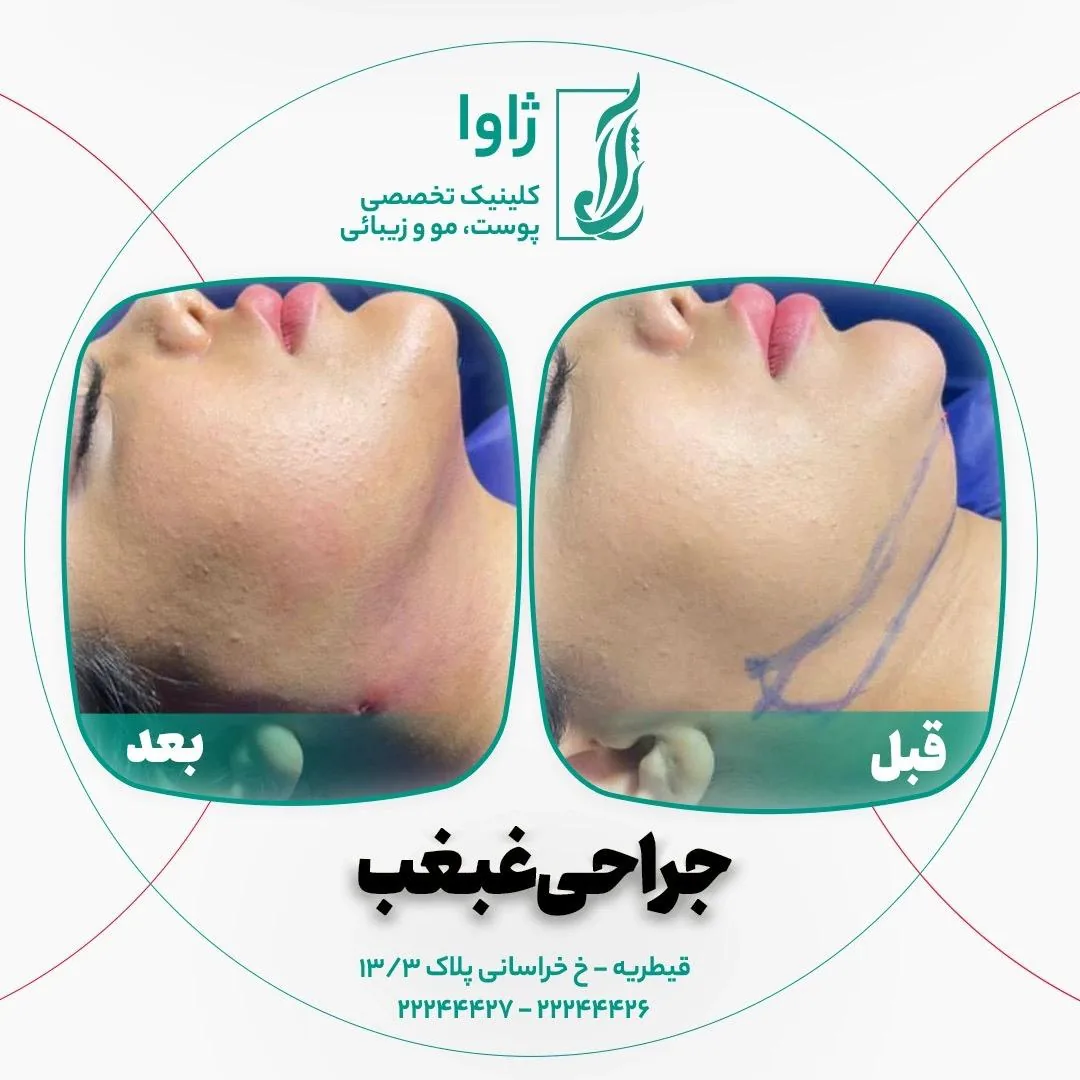 کلینیک زیبایی، جراحی و لاغری ژاوا - تصویر 2