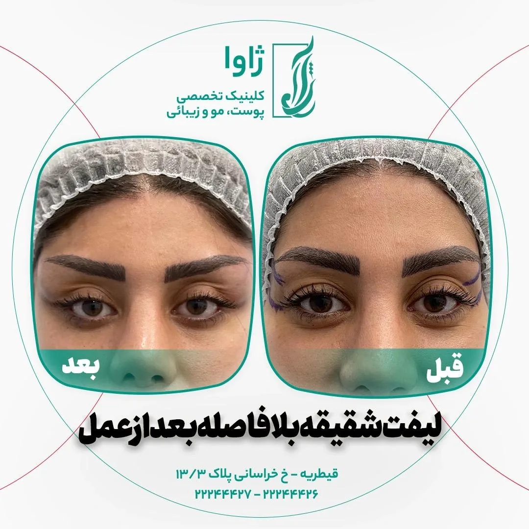 کلینیک زیبایی، جراحی و لاغری ژاوا - تصویر 3
