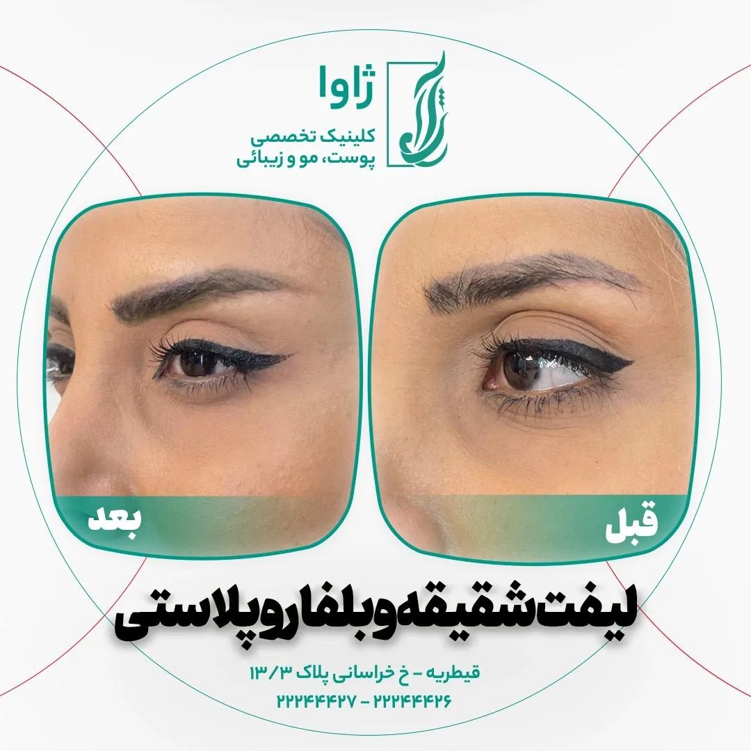 کلینیک زیبایی، جراحی و لاغری ژاوا - تصویر 4