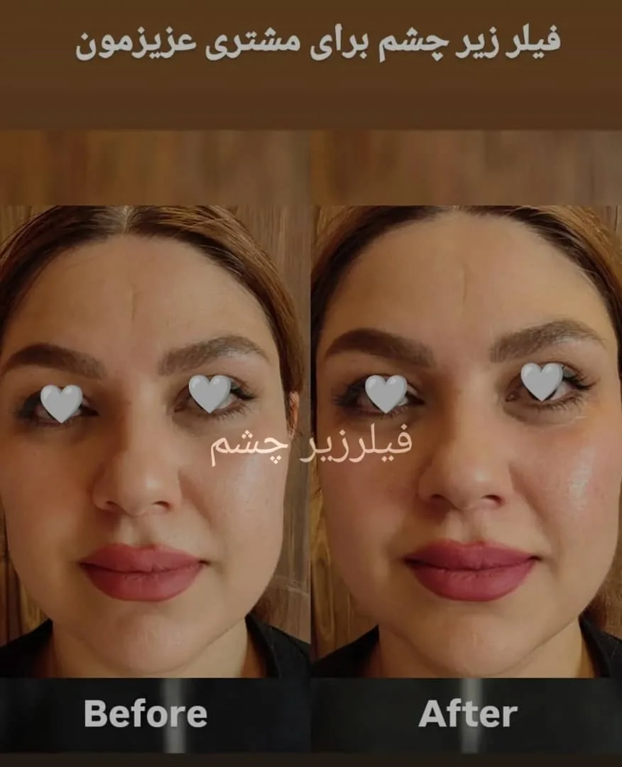 مرکز زیبایی الماس درخشان - تصویر 2