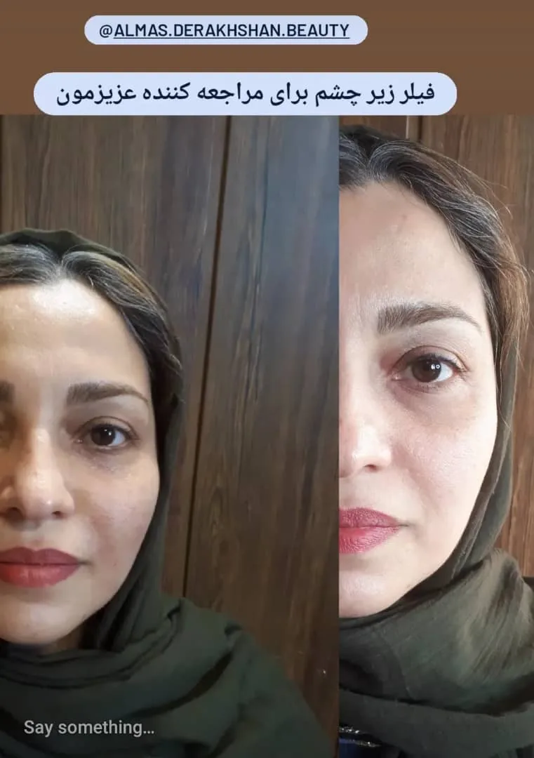 مرکز زیبایی الماس درخشان - تصویر 3