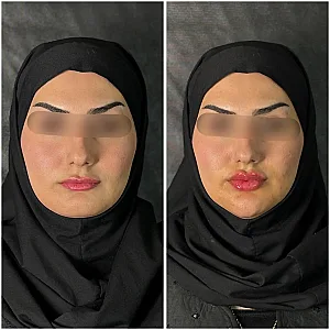 مجموعه لاغری لیزر و زیبایی کارنا