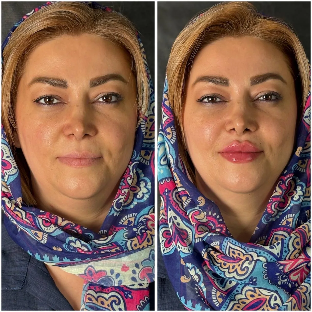 مجموعه لاغری لیزر و زیبایی کارنا - تصویر 2