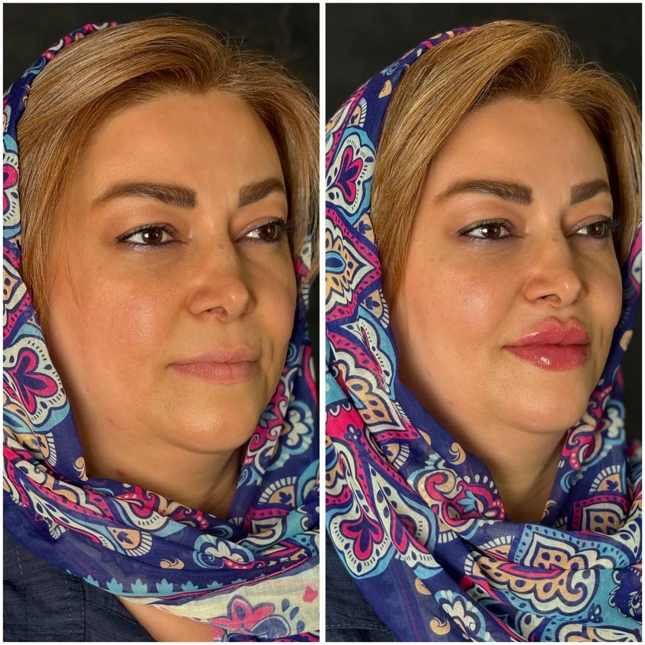 مجموعه لاغری لیزر و زیبایی کارنا - تصویر 3