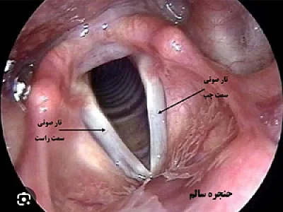 استروبوسکوپی حنجره تهران، سعادت آباد و شهرک غرب  (مرکز عکسبرداری از حنجره در تهران)