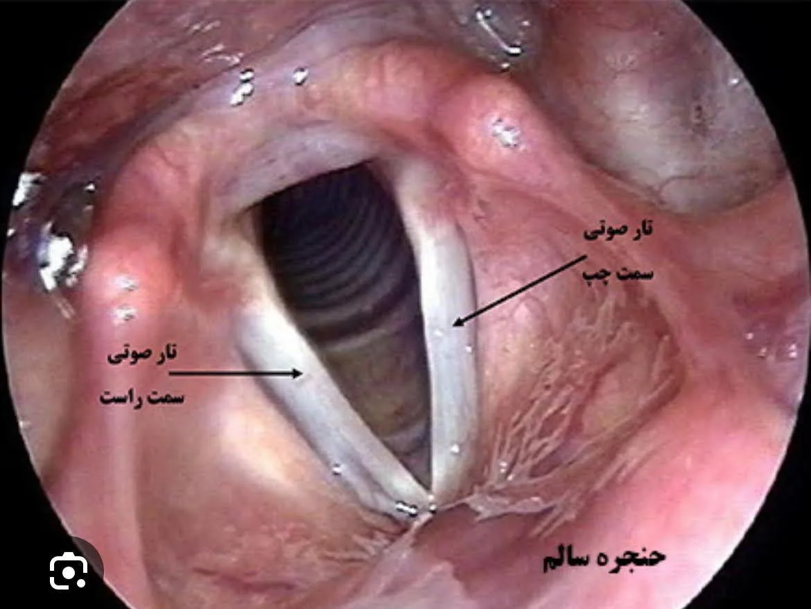 استروبوسکوپی حنجره تهران، سعادت آباد و شهرک غرب  (مرکز عکسبرداری از حنجره در تهران)