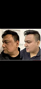 فشیال تخصصی و درمانی میسون(30درصد تخفیف)