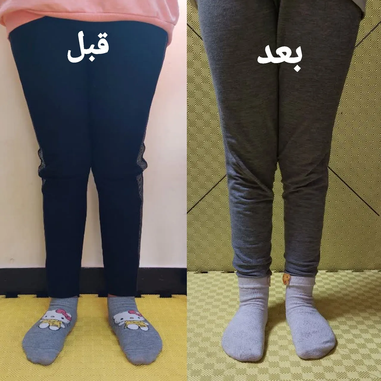 ارتوپدی فنی پایش - تصویر 3