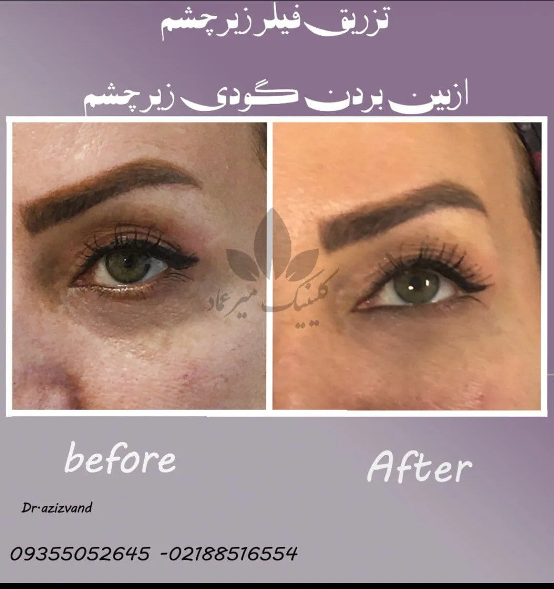 مرکز جراحی پوست و مو میر عماد