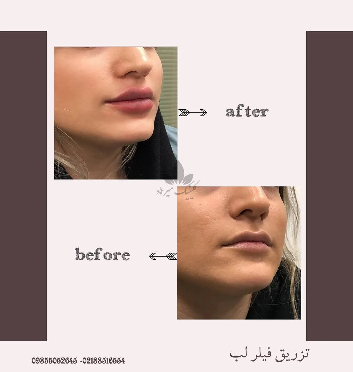 مرکز جراحی پوست و مو میر عماد - تصویر 2