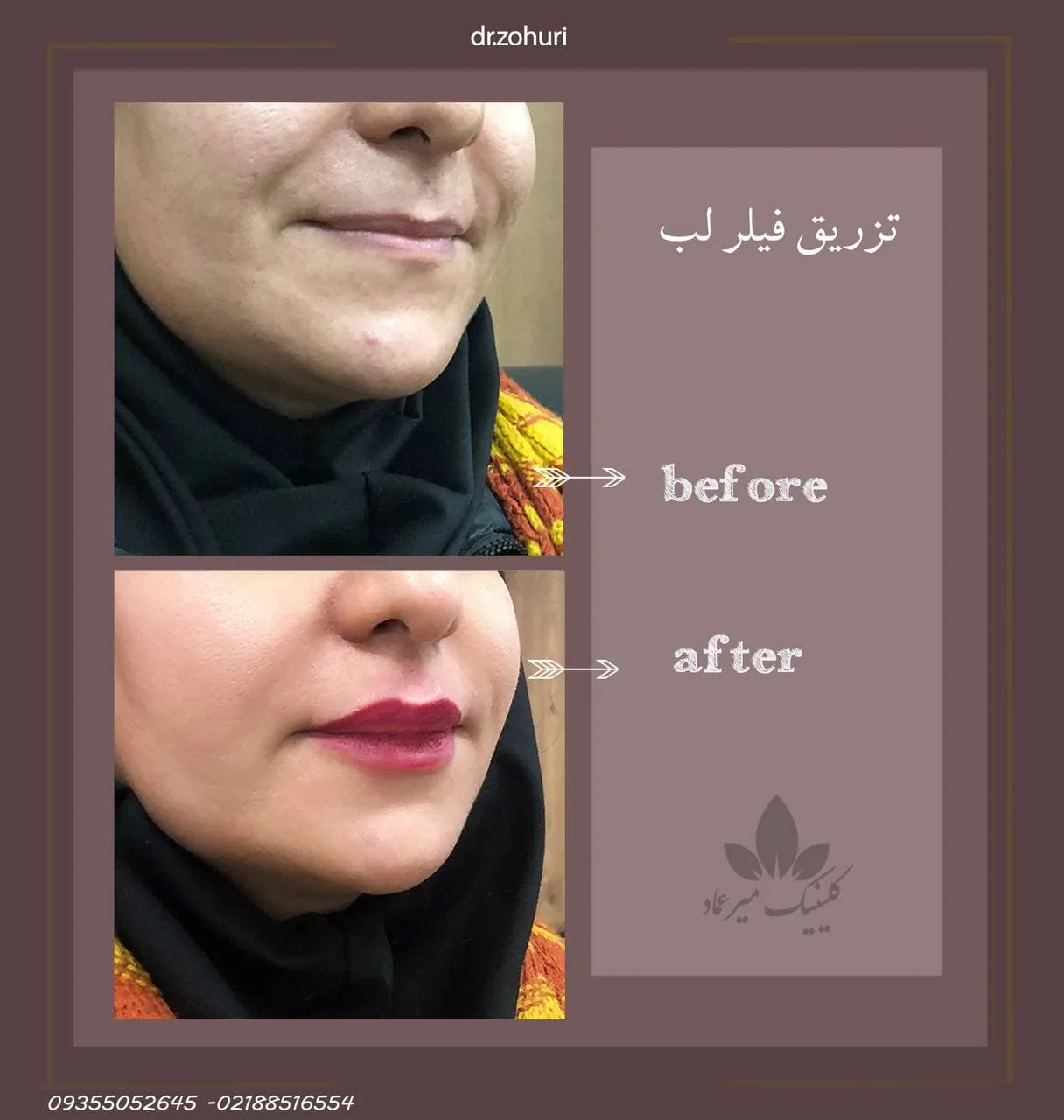 مرکز جراحی پوست و مو میر عماد - تصویر 3