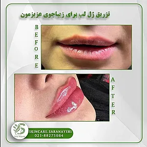 مجموعه زیبایی پوست و مو سارا نیری
